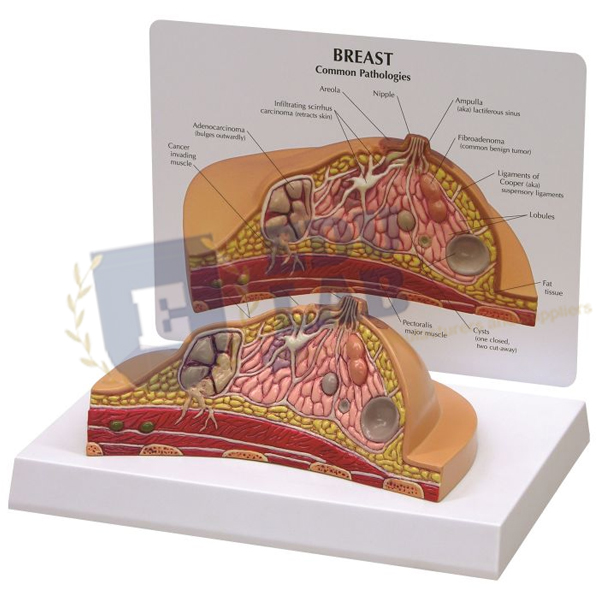Breast Anatomy Model