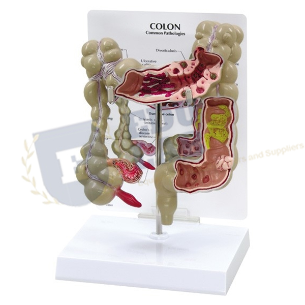 Colon Model